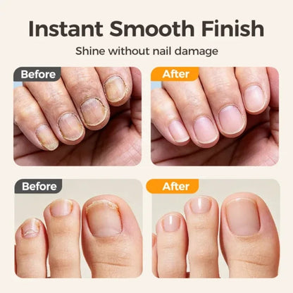 KORAKIO® 2-in-1 Smart Nail Trimmer – Trim & Polish with Ease